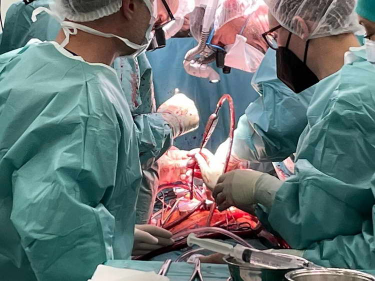 За првпат во историјата на македонското здравство направена експлантација на коски и коскени ткива од починат донор